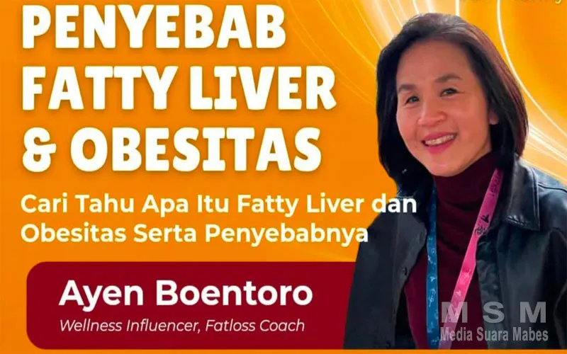 Penyebab Fatty dan Obesitas